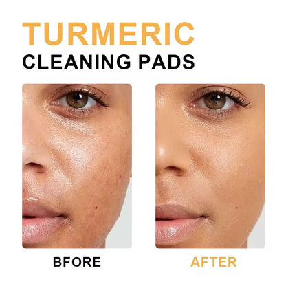 OEM/ODM Herbal Stock Kojic Acid Cleansing Pads 40pads Gentle Exfoliating Cotton Sheet with Turmeric for Facial Care