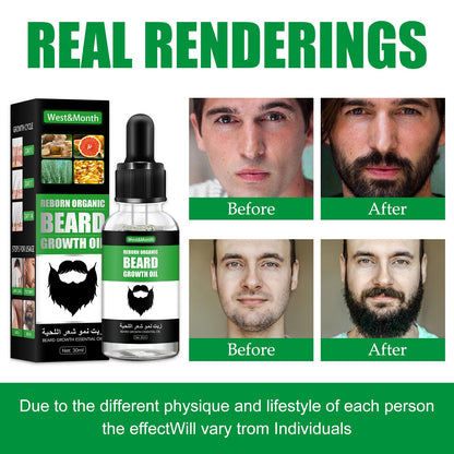 OEM/ODM Men's Beard Growth 30ml Promote Beard Chest Hair Growth Nourishing