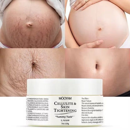 Wholesale Customization Collagen Postpartum Stretch Mark Repair Cream Firming Nourishing Fading Body Care