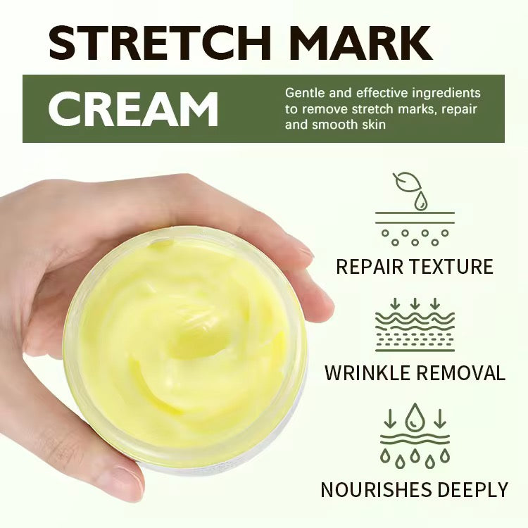 Wholesale Customization Collagen Postpartum Stretch Mark Repair Cream Firming Nourishing Fading Body Care