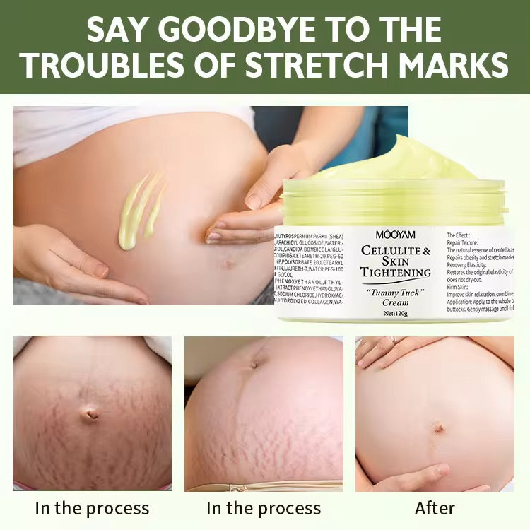 Wholesale Customization Collagen Postpartum Stretch Mark Repair Cream Firming Nourishing Fading Body Care