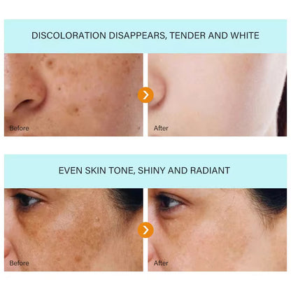 Wholesale Customization Dark Spot Removal Cream Whitening Freckle Cream Hydrating Moisturizing for All Skin Types