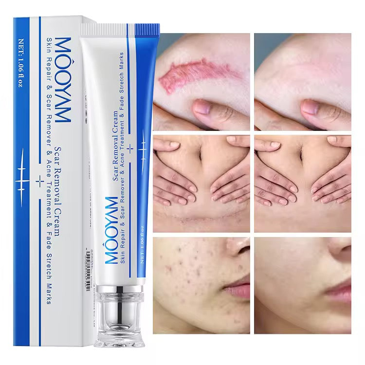 Wholesale Custom Creams & Lotions Scar Nourishing Repair Removal Moisturizing Repair Creams