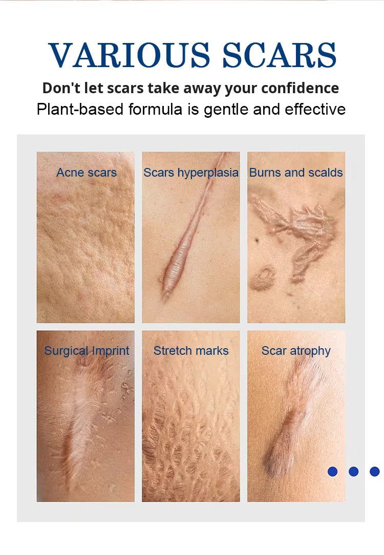 Wholesale Custom Creams & Lotions Scar Nourishing Repair Removal Moisturizing Repair Creams