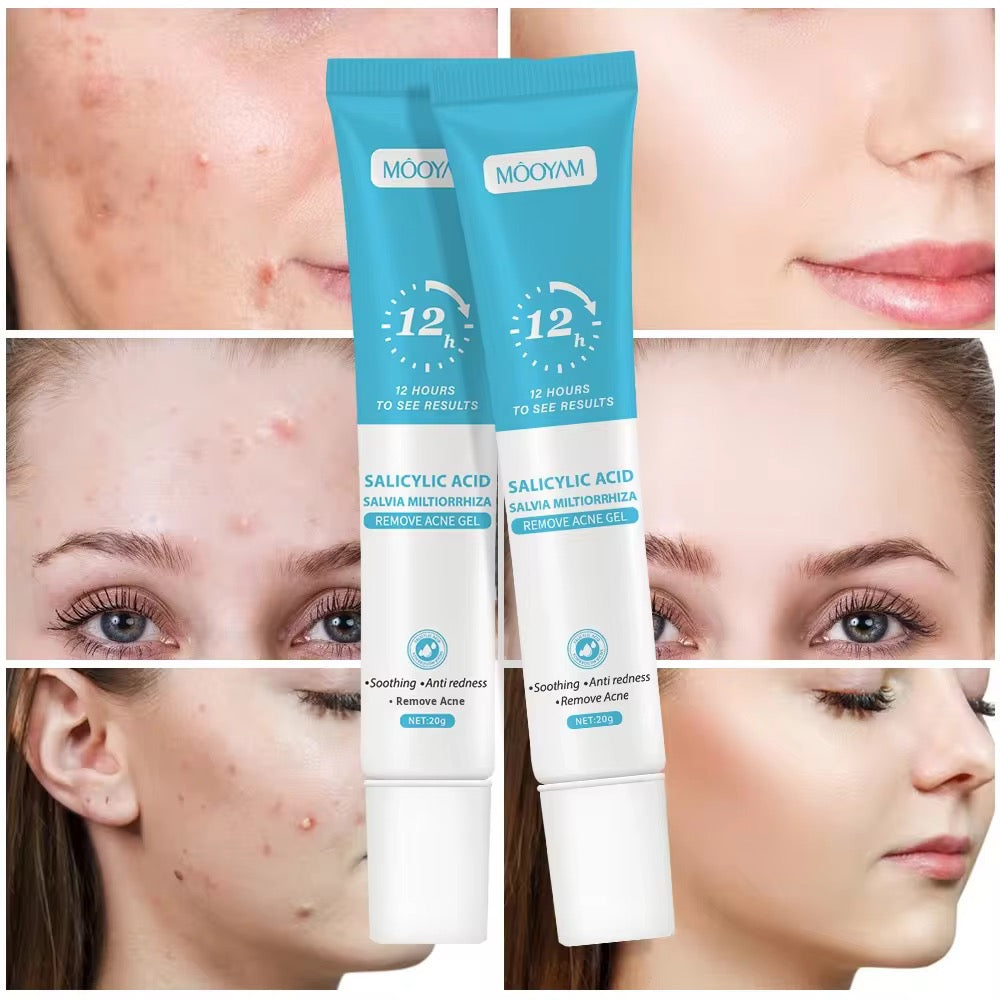 Wholesale Customized Salicylic Acid Acne Gel Plant Essence Cream Lotion for Fading Acne Marks Closed Pore Shrinkage Acne Removal