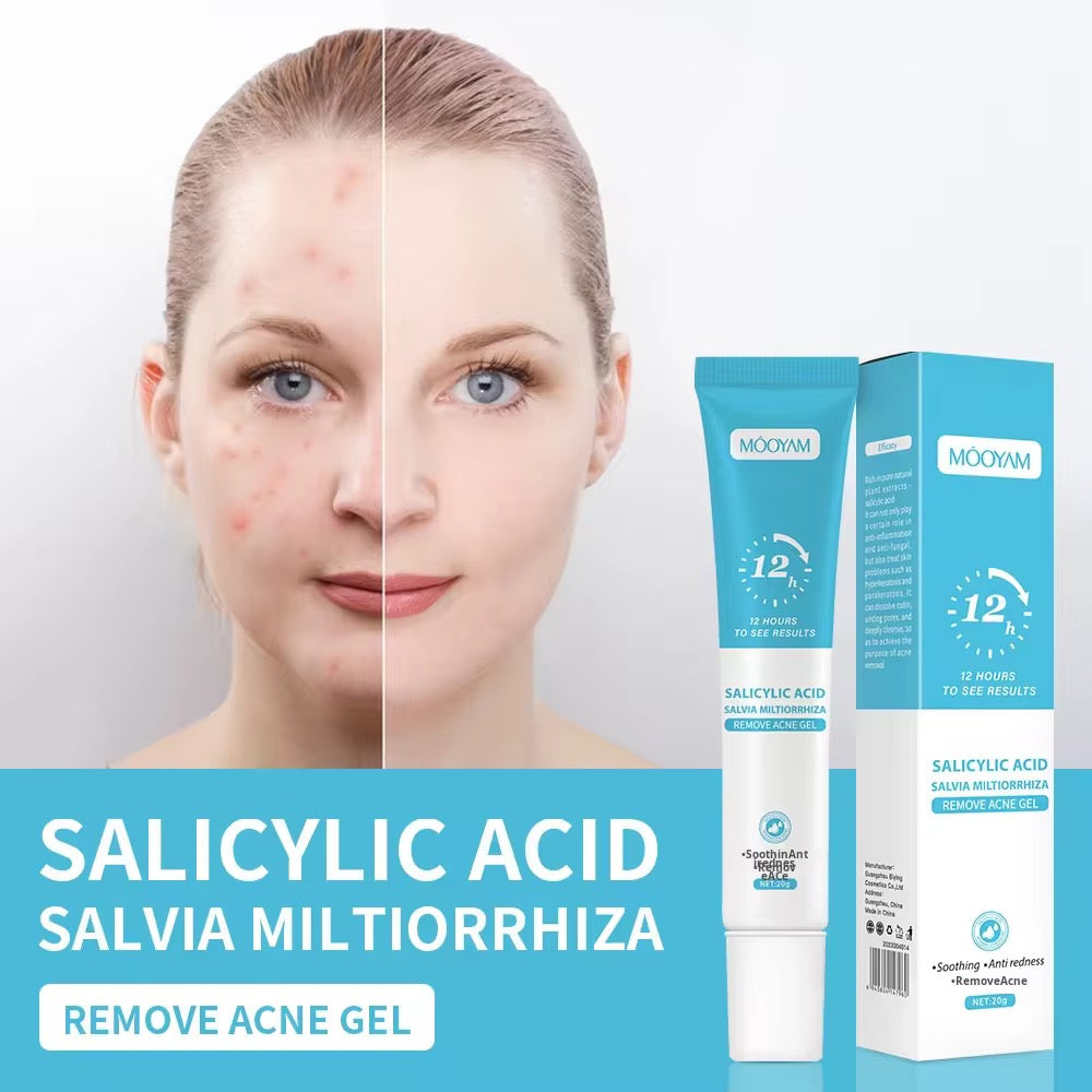 Wholesale Customized Salicylic Acid Acne Gel Plant Essence Cream Lotion for Fading Acne Marks Closed Pore Shrinkage Acne Removal