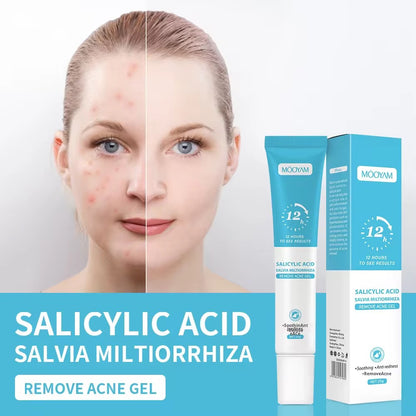 Wholesale Customized Salicylic Acid Acne Gel Plant Essence Cream Lotion for Fading Acne Marks Closed Pore Shrinkage Acne Removal