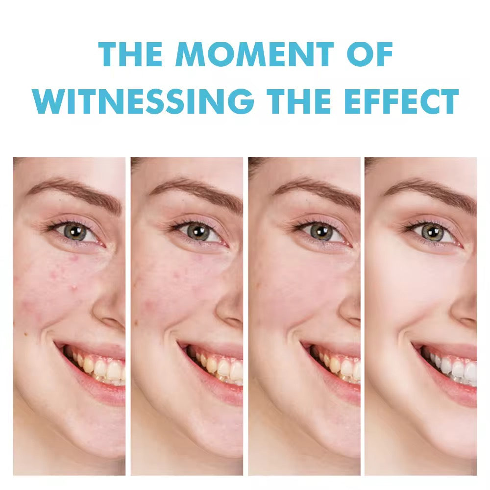 Wholesale Customized Salicylic Acid Acne Gel Plant Essence Cream Lotion for Fading Acne Marks Closed Pore Shrinkage Acne Removal