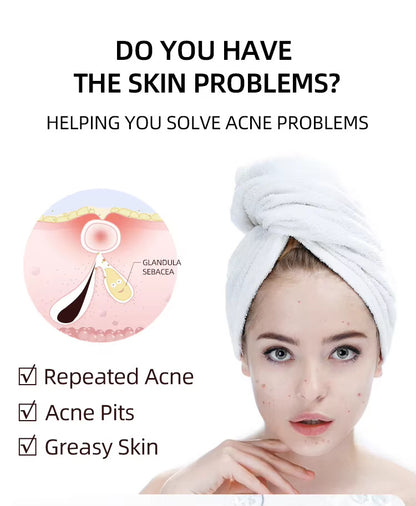 Wholesale Customized Salicylic Acid Acne Gel Plant Essence Cream Lotion for Fading Acne Marks Closed Pore Shrinkage Acne Removal