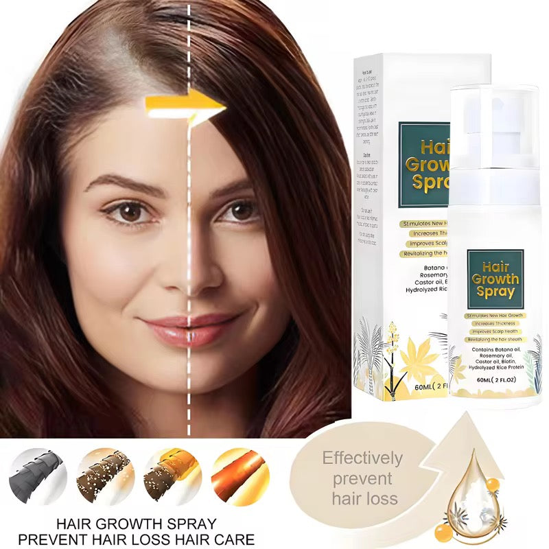 OEM Wholesale 60ml/bottle Natural Organic Thicker Nurturing Scalp Fast Hair Growth Oil Spray for Men and Women Anti Loss