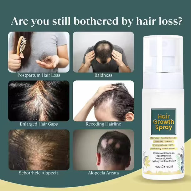 OEM Wholesale 60ml/bottle Natural Organic Thicker Nurturing Scalp Fast Hair Growth Oil Spray for Men and Women Anti Loss